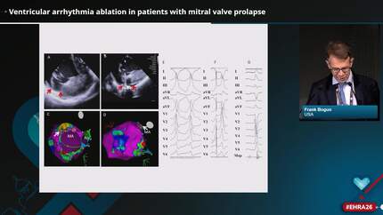 Ventricular arrhythmia ablation in patients with mitral valve prolapse