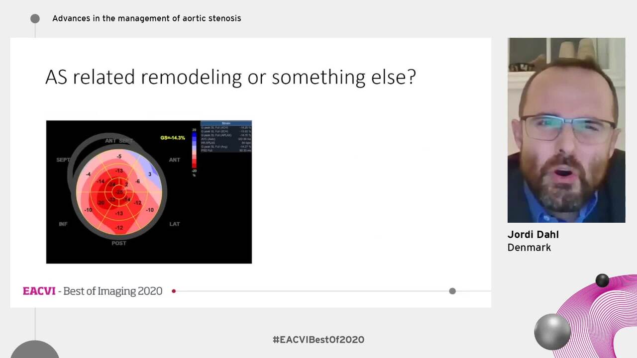 Advances in the management of aortic stenosis