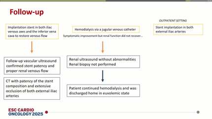 When the heart is not the only culprit: vascular obstruction mimicking heart failure in carcinoid disease