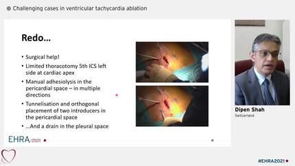 Presentation thumbnail