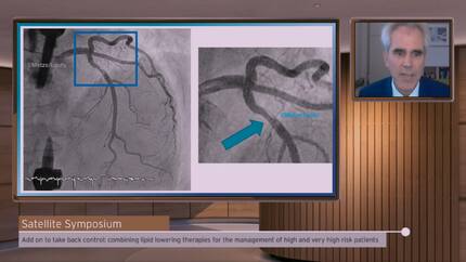 Add on to take back control: Combining lipid lowering therapies for the management of high and very high risk patients