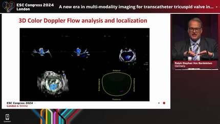 Presenting revolutionary artificial intelligence (AI) that allows you to transcend the complexities of echocardiography
