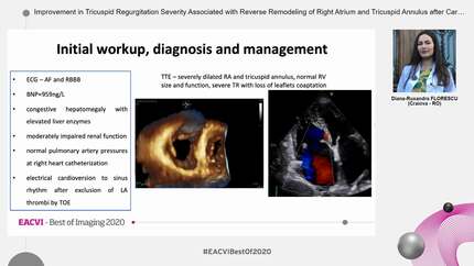 Improvement in Tricuspid Regurgitation Severity Associated with Reverse Remodeling of Right Atrium and Tricuspid Annulus after Cardioversion of Atrial Fibrillation  a Proof of Concept.