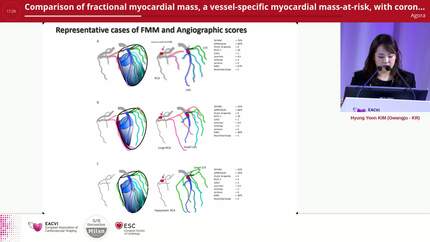 Comparison of fractional myocardial mass, a vessel-specific myocardial mass-at-risk, with coronary angiographic scoring systems for predicting myocardial ischemia