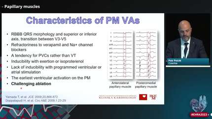 How to approach VT originating from specific locations