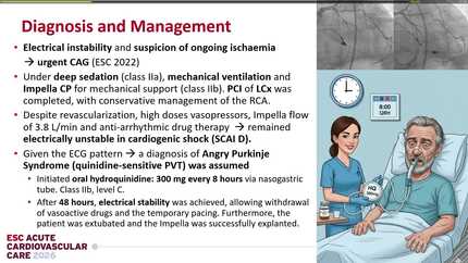 Polymorphic ventricular tachycardia in ischaemic heart disease: the Angry Purkinje syndrome
