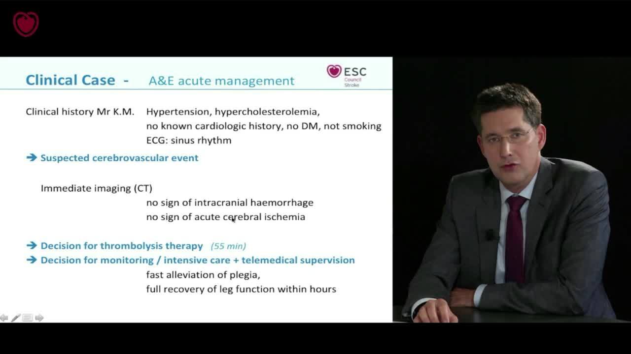 Council on Stroke Webinar : Routine search for underlying cause of ischemic stroke