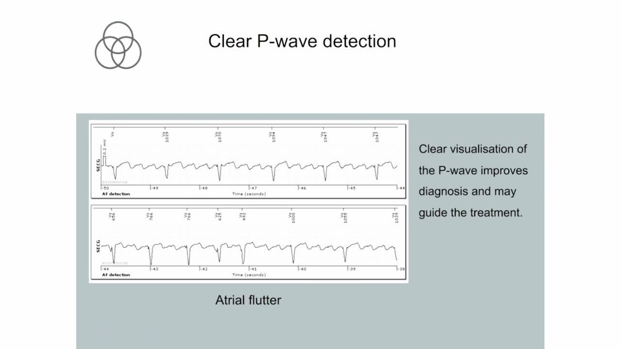 Implantable Cardiac Monitors.