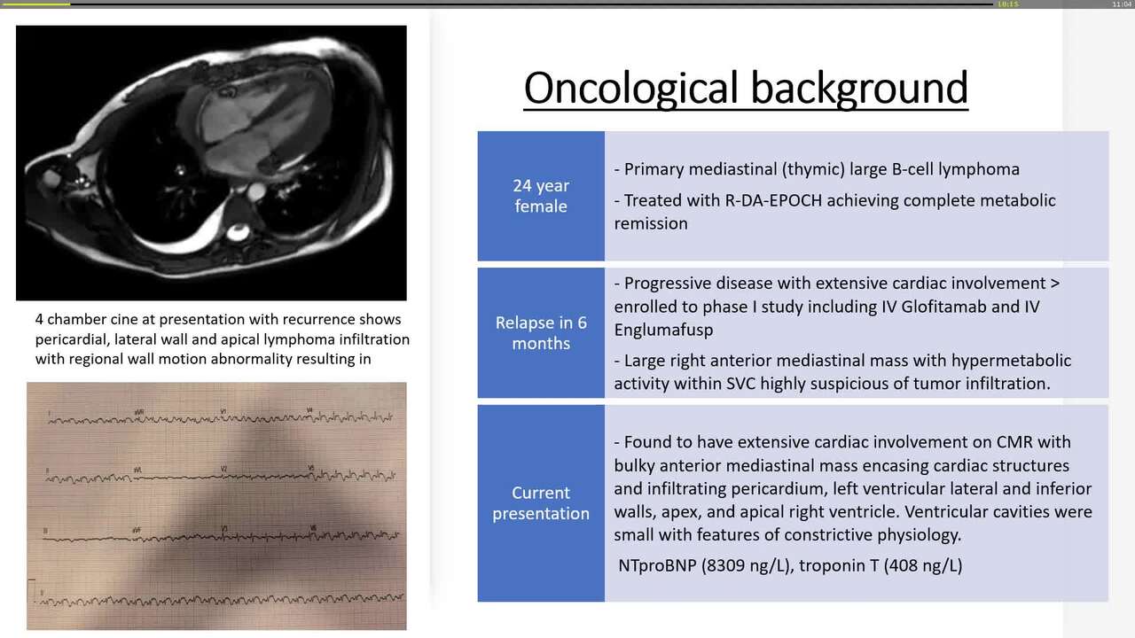 Diagnostic uncertainties and the role of multimodality imaging
