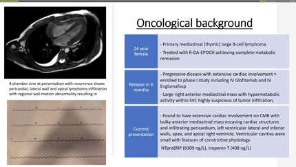 Diagnostic uncertainties and the role of multimodality imaging