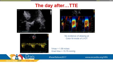 Presentation thumbnail