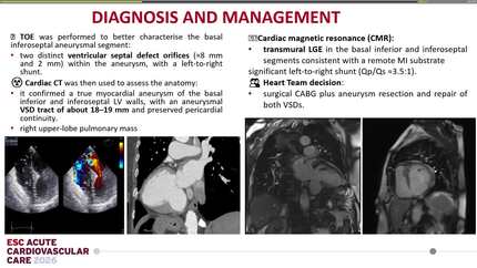 Residual post-infarct ventricular septal defects: a rare mechanical complication presenting within the ACS spectrum