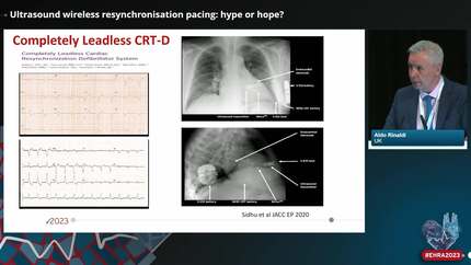 Presentation thumbnail