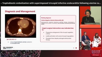 When endocarditis isn’t the whole story