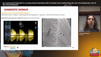 An unexpected diagnosis in a young male presenting with tricuspid valve dysfunction  the ever-increasing key role of 3D echocardiogram
