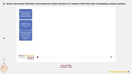 Acute myocardial infarction and impaired cardiac function in a patient with thick skin overlapping aching muscles.