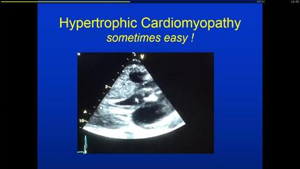 Presentation thumbnail