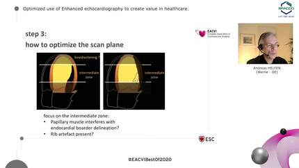 Enhanced Echocardiography During the COVID-19 Pandemic: clinical practice, patient management and technical optimization 