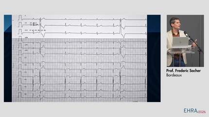 Challenging electrocardiograms and complex cases: how do I get on the right track?