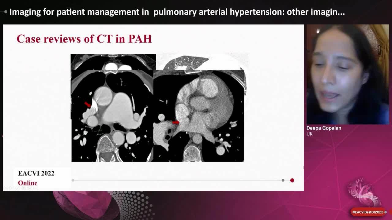 Imaging for patient management in  pulmonary arterial hypertension: other imaging modalities.