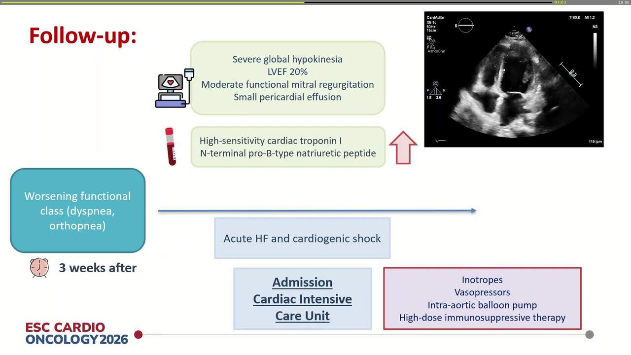 When cardiotoxicity strikes the heart: lessons from real cases