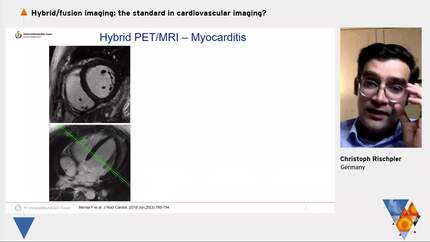 PET/CT and PET/MR in cardiovascular imaging.