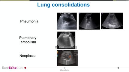 Presentation thumbnail