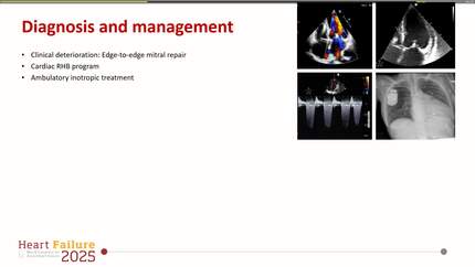 Presentation thumbnail
