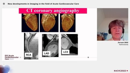 Presentation thumbnail