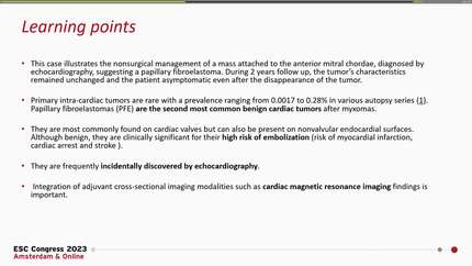 Papillary fibroelastoma of the mitral valve chordae: A happy ending story