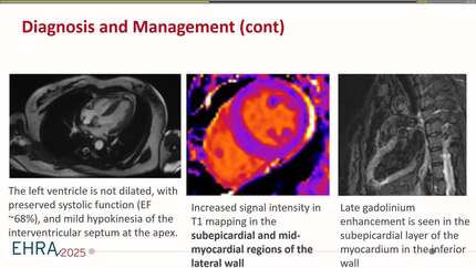 Presentation thumbnail