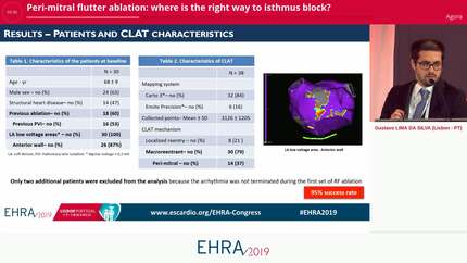 Peri-mitral flutter ablation: where is the right way to isthmus block?