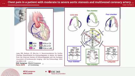 Chest pain in a patient with moderate to severe aortic stenosis and multivessel coronary artery disease. What is the reason for the pain?. Hybrid imaging has the answer: fusion of 3D speckle-tracking stress echocardiography and coronary tomography.