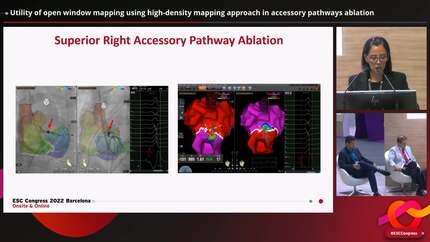 Utility of open window mapping using high-density mapping approach in accessory pathways ablation