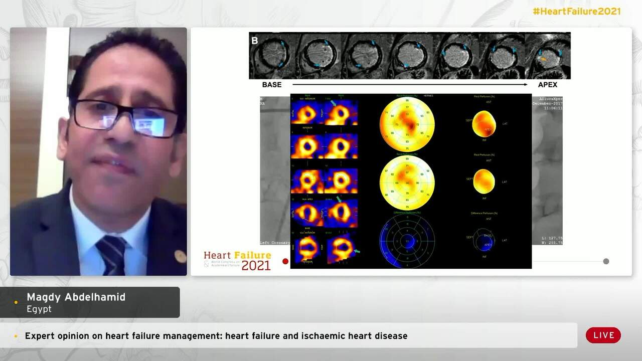 Expert opinion on heart failure management: heart failure and ischaemic heart disease - What is the evidence?