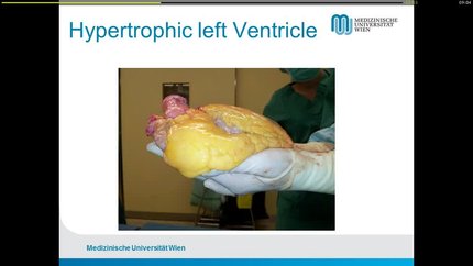 Presentation thumbnail