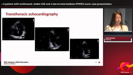 Presentation thumbnail