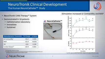 Transvenous stimulation of cardiac autonomic nerves improves hemodynamics