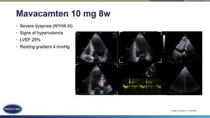 Presentation thumbnail