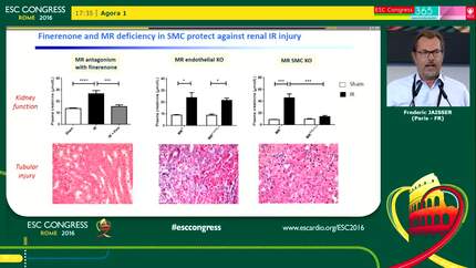 Benefit of finerenone in renal ischemia/reperfusion injury: mandatory role of the vascular smooth muscle mineralocorticoid receptor