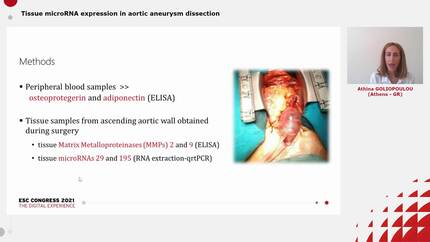 Tissue microRNA expression in aortic aneurysm dissection 