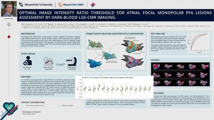 Optimal image intensity ratio threshold for atrial focal monopolar pulsed field ablation lesions assessment by dark-blood late gadolinium enhancement cardiac magnetic resonance imaging.