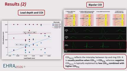 Revisiting unipolar and bipolar current of injury during left bundle branch area pacing: clarifying electrophysiological signatures and diagnostic pitfalls