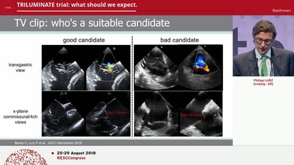 Presentation thumbnail