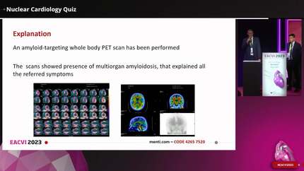 Nuclear Cardiology Quiz