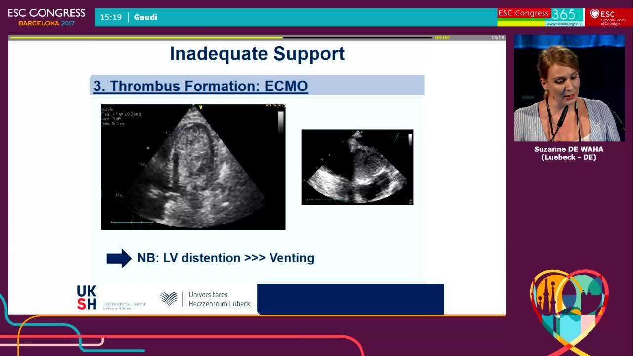 Short-term mechanical circulatory support.