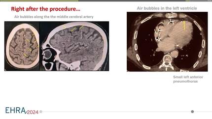 Presentation thumbnail