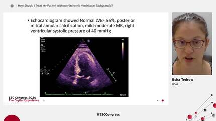 Presentation thumbnail