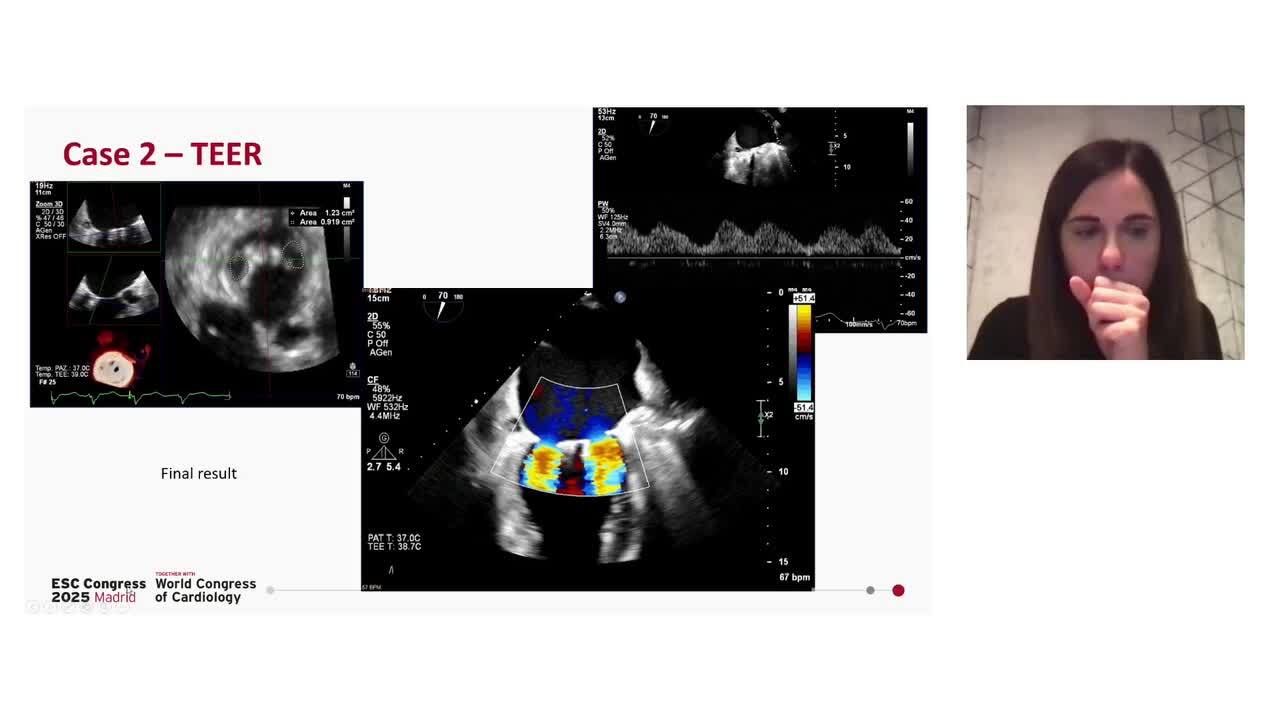 2025 ESC Guidelines on Valvular heart disease: what's new in mitral regurgitation?