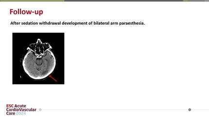 Presentation thumbnail